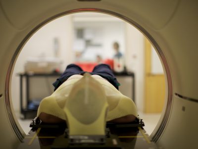 MRI scan