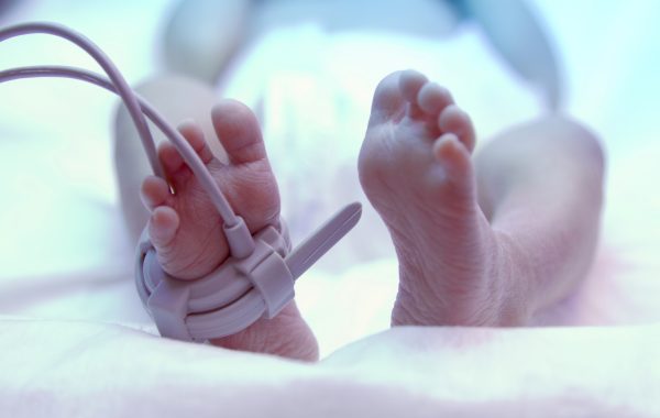 Feet of a premature new born baby under ultraviolet lamp